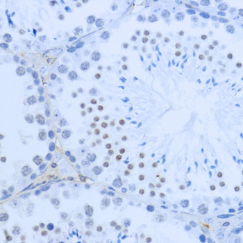 H3K36me2 Antibody