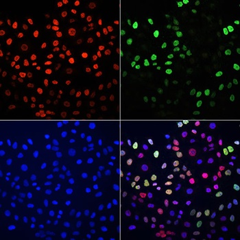 H3K36me2 Antibody