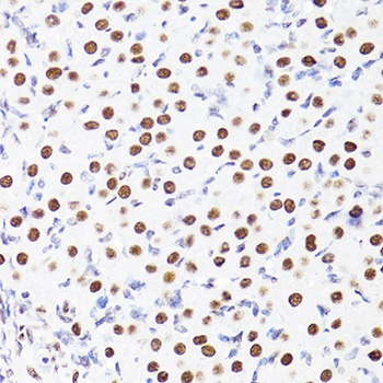 TriMethyl-Histone H3-K27 pAb