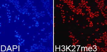 TriMethyl-Histone H3-K27 pAb
