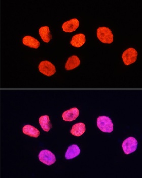TriMethyl-Histone H3-K27 pAb