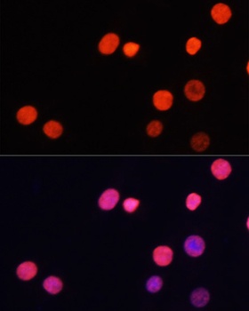 TriMethyl-Histone H3-K27 pAb