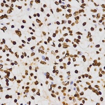 H3K27me2 Antibody