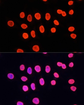 MonoMethyl-Histone H3-K27 pAb