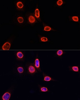 MonoMethyl-Histone H3-K9 pAb