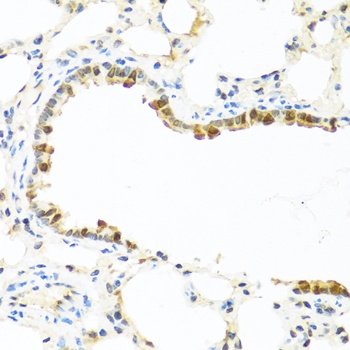 APCS Antibody
