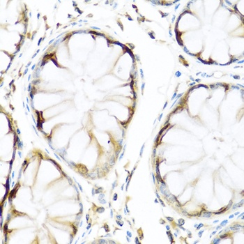 APCS Antibody