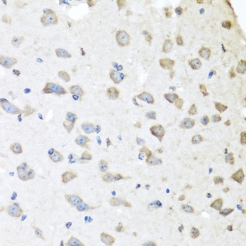 APCS Antibody