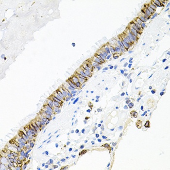ACVR2A Antibody