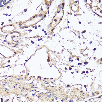 VEGFA Antibody