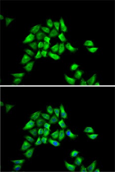 DCTN1 Antibody