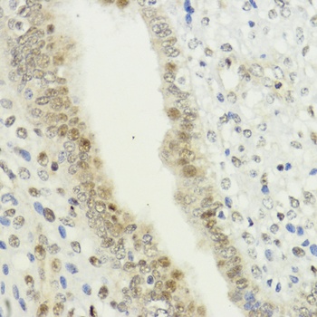 LDB1 Antibody