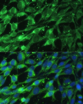Lamin A / C Antibody