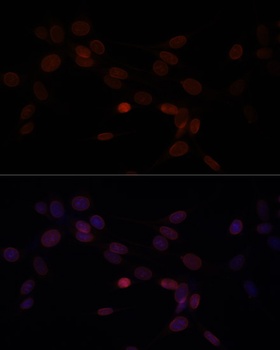 Lamin A / C Antibody