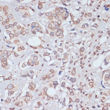 Lamin A / C Antibody
