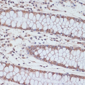 Lamin A / C Antibody