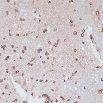 Lamin A / C Antibody