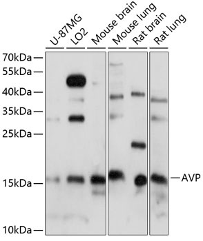 AVP Antibody