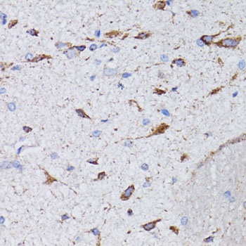 AVP Antibody