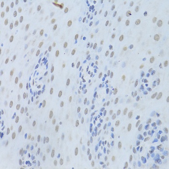 HNRNPK Antibody