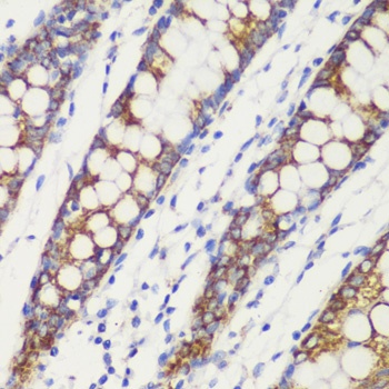 TOM20 Antibody