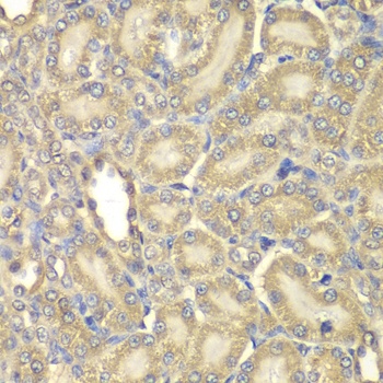 Myelin Basic protein Antibody