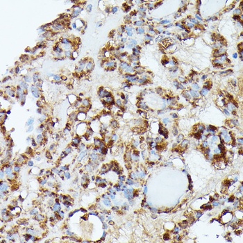 NUBP1 Antibody