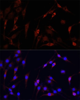 VDAC1 Antibody