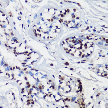 p27 KIP 1 Antibody