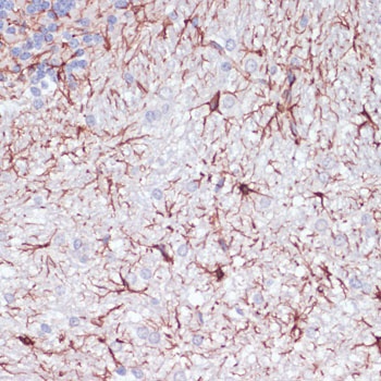 GFAP Antibody