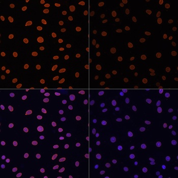 H4K12ac Antibody