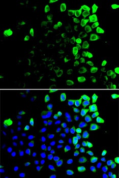 SLAMF7 Antibody