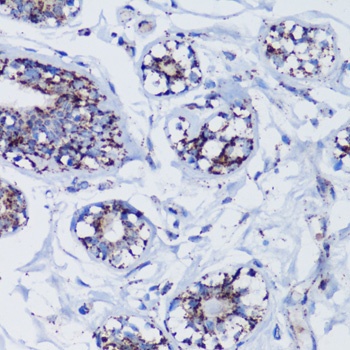 TFAM Antibody