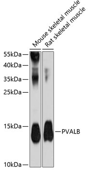 PVALB Antibody
