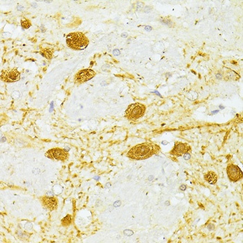 PVALB Antibody