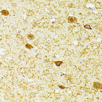 PVALB Antibody