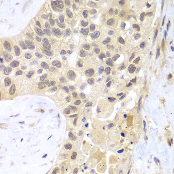 PSMC5 Antibody