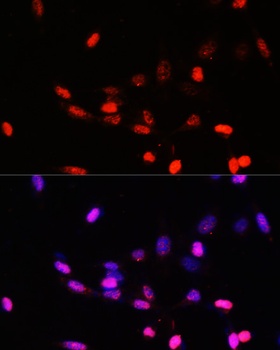 COPS5 Antibody