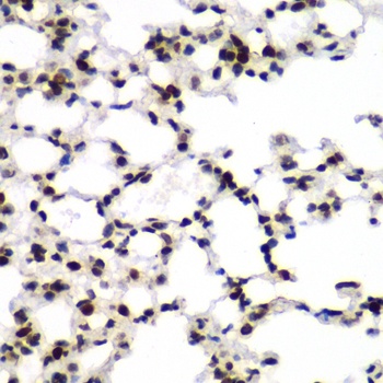 GNB2L1 Antibody