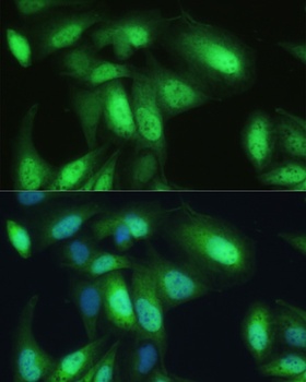 VCP Antibody