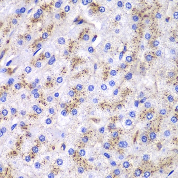 CTSD Antibody