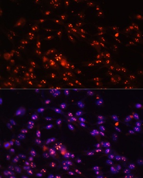 DKC1 Antibody
