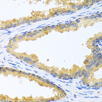 KLK11 Antibody