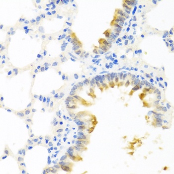 KLK11 Antibody