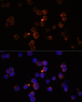 Iba1 Antibody