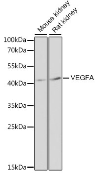 VEGFA Antibody