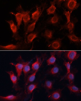 VEGFA Antibody