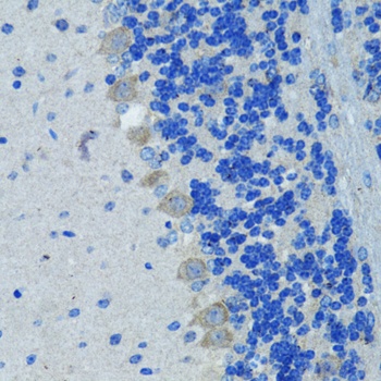 NES Antibody