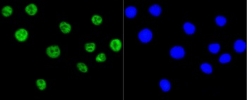PRKCA Antibody [45F9]