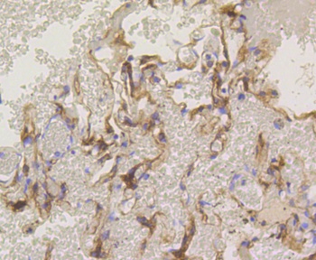 PRKCA Antibody [45F9]